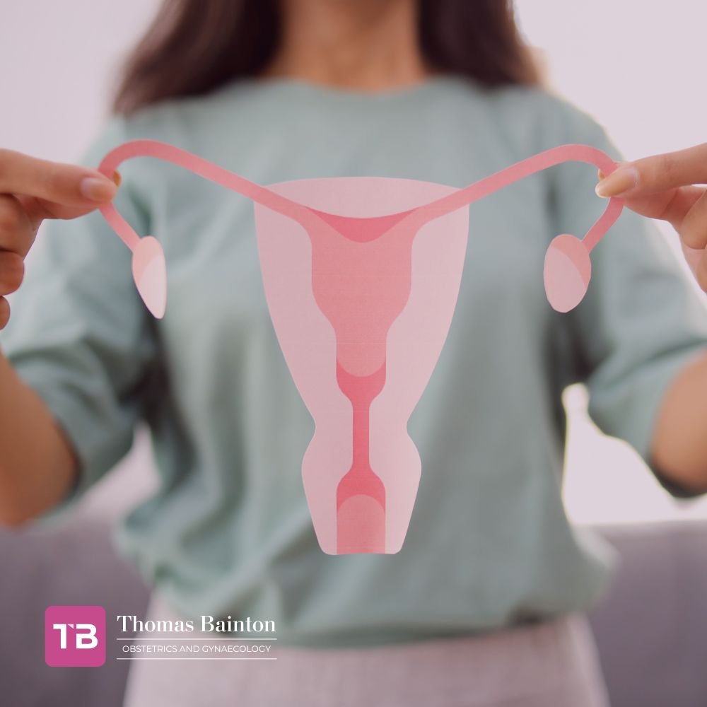 PCOS Treatment - Thomas Bainton